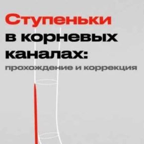 Ступеньки в корневых каналах: прохождение и коррекция (Дмитрий Николаев)