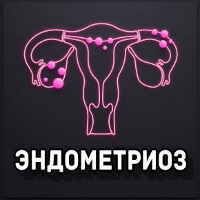 [nativalife] Эндометриоз (Виктория Самира)