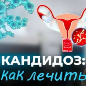 Кандидоз и методы лечения (Александра Петренко)