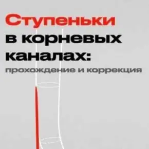 Ступеньки в корневых каналах: прохождение и коррекция (Дмитрий Николаев)